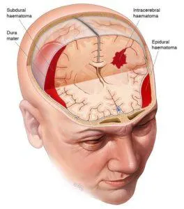 10 Unhealthy Habits That Can Negatively Impact Your Brain Health